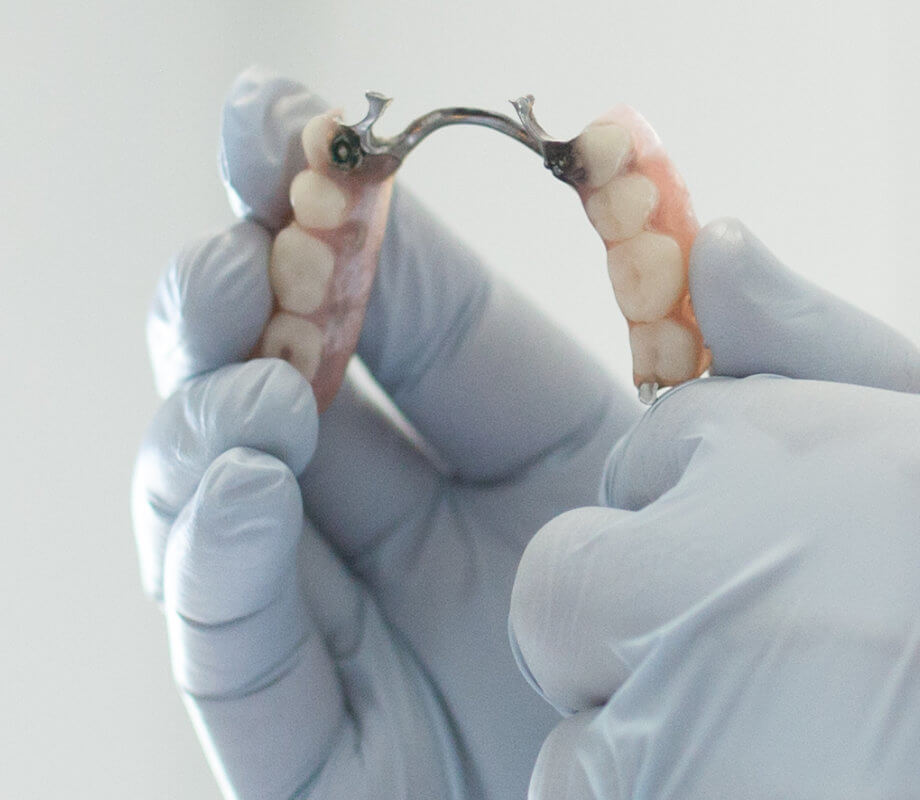 Dental prosthesis