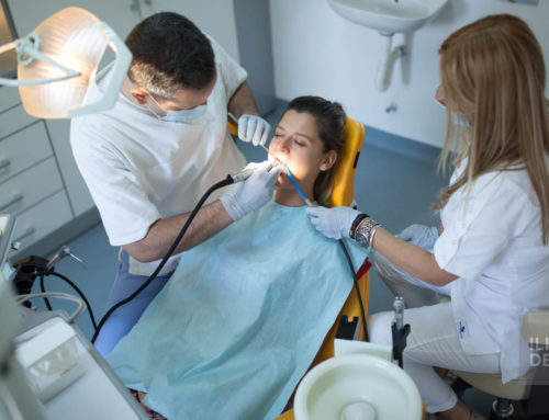How are fillings done?